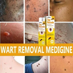 Tag recede bee venom spary wart remover buang tahi lalat ubat kutil ketuat remover skin tag mole remover smooth skin